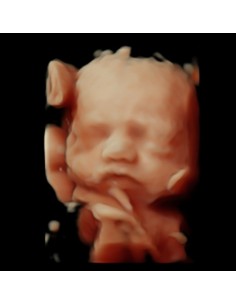 copy of 8k ultrasound, hyperrealistic ultrasound and... 2