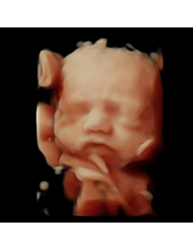 Pack mini centros ecográficos