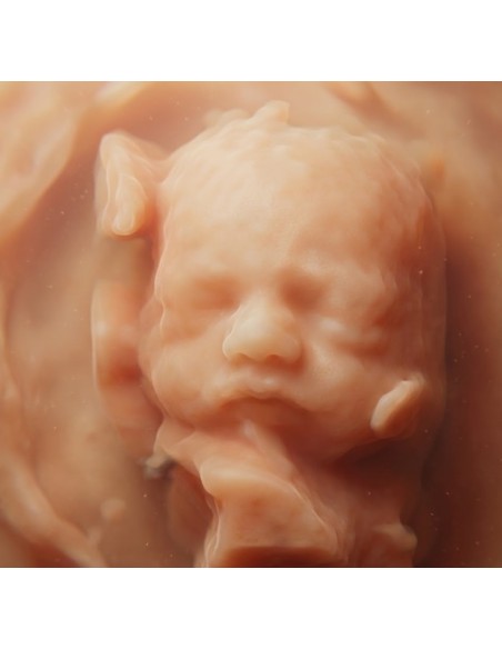 copy of 8k ultrasound, hyperrealistic ultrasound and hyperrealistic reconstruction video