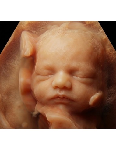 copy of 8k ultrasound, hyperrealistic...