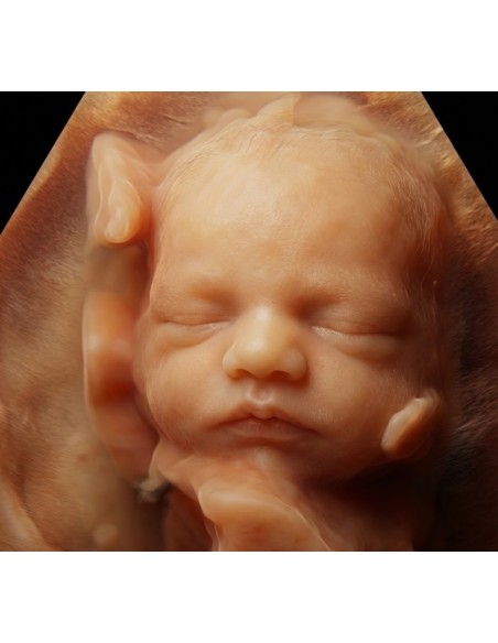 copy of 8k ultrasound, hyperrealistic ultrasound and hyperrealistic reconstruction video