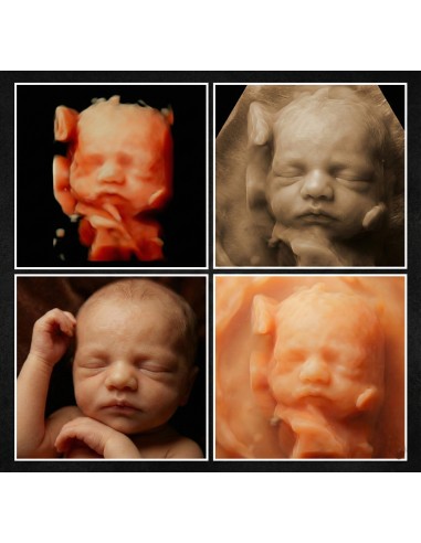 copy of 8k ultrasound, hyperrealistic...