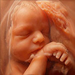 Imagen hiperrealista